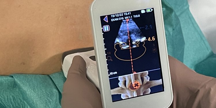 In ospedale un ecografo a ultrasuoni 3D agevola l’anestesia epidurale e spinale