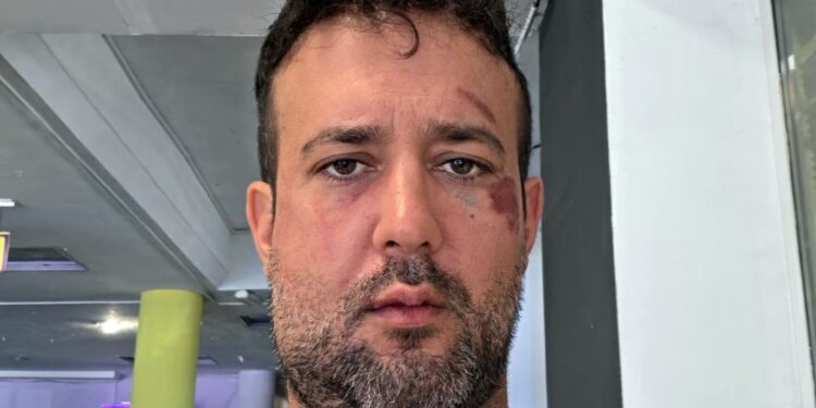 Ferito in Ucraina Adriano Stabile, segretario provinciale del Partito democratico